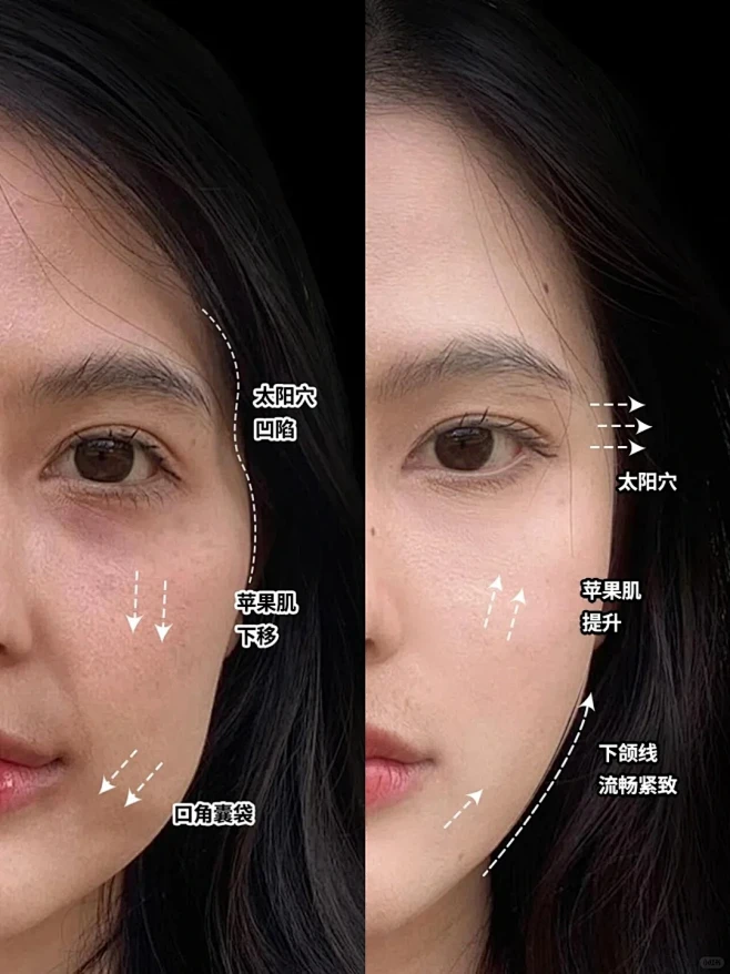 光“填”起来不够，还要“提”起来！ - ...