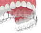 牙齿png (197)