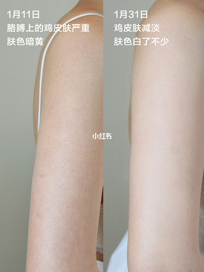 真的是神仙身体乳啊❗️美白去鸡皮❗️超能...
