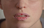Dermatillomania皮肤采摘。女人有坏习惯挑她的嘴唇。基于焦虑压力和嘴唇干燥的有害成瘾。 Excoriation障碍。生病破裂的受损组织。照片素材-图片ID：304107661