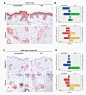 Aging | Cellular retinoic acid binding protein-II expression and its potential role in skin aging - Full Text