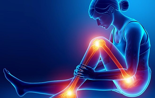 arthritis