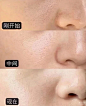 医美项目详情 - 小红书搜索