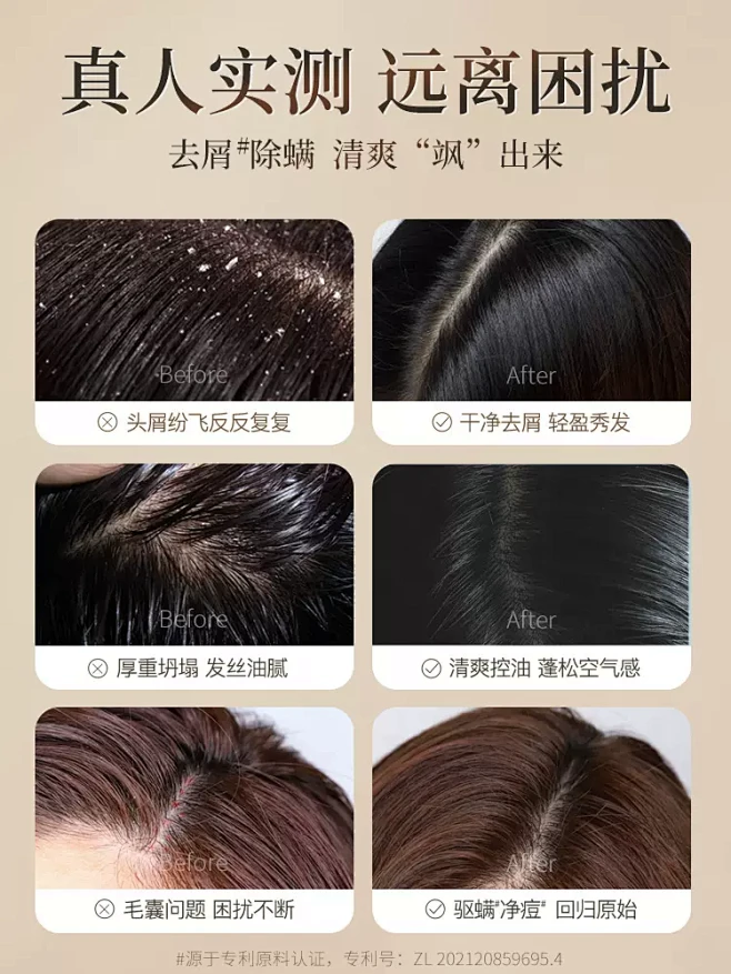 仁和洗发水去屑止痒正品头皮屑严重去头屑药除螨控油专用洗头膏露-tmall.com天猫