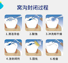 蒋小月子采集到儿童口腔