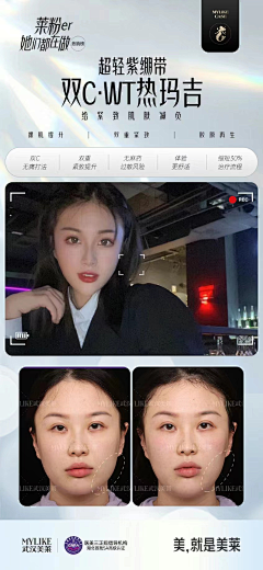 阿球不是球采集到医美案例