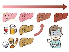 肝病進展圖圖圖 - 脂肪肝 幅插畫檔、美工圖案、卡通及圖標