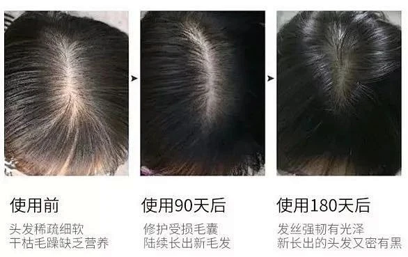 发觉防脱育发精华液真的假的？效果大揭秘！！-花瓣网