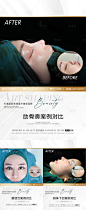 医美整形案例长图海报-源文件