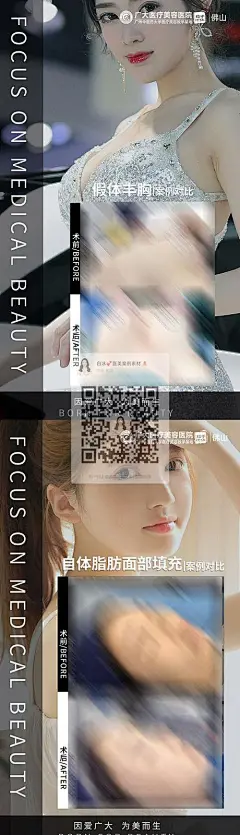 医美案例_精选医美案例下载_医美全系案例素材前后对比图