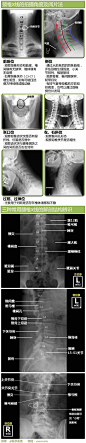 一图读懂 l 颈腰椎X线