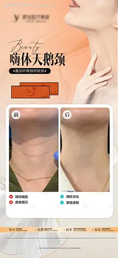 源文件下载【嗨体天鹅颈去颈纹案例海报】编号：44320026629446605