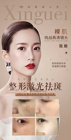 医美整形美容祛斑海报-设计素材-shejisc.cn