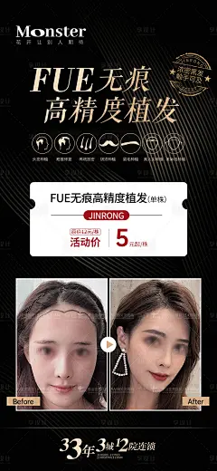 医美FUE无痕高精度植发海报-源文件