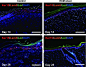 Full-Thickness Skin Wound Healing Using Human Placenta-Derived Extracellular Matrix Containing Bioactive Molecules