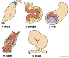 子静君竹irina恬小喵采集到医学与健康