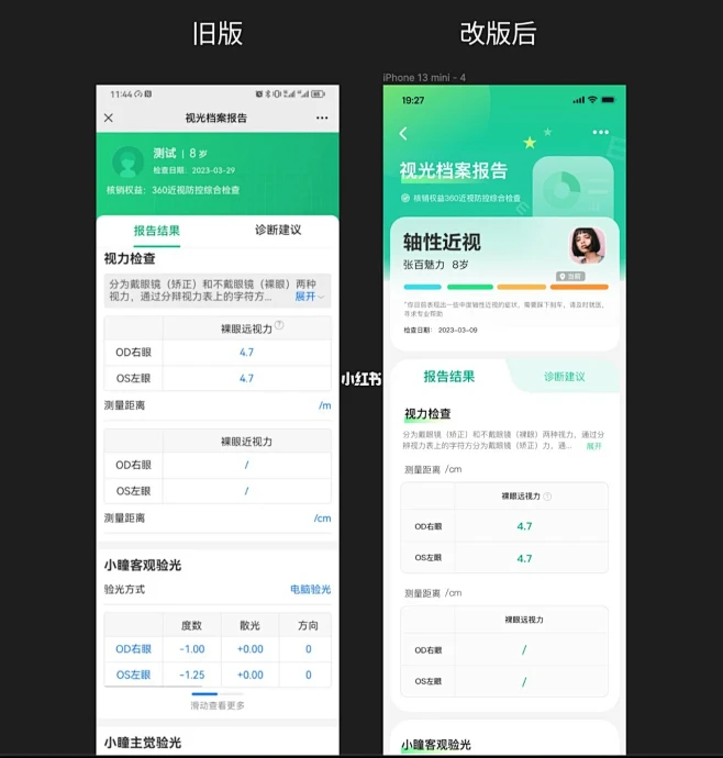 UI项目进行中，视力测试APP界面改版