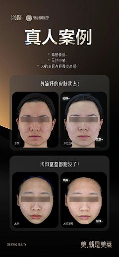 我只吃一小碗采集到案例