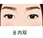 眼部问题  08