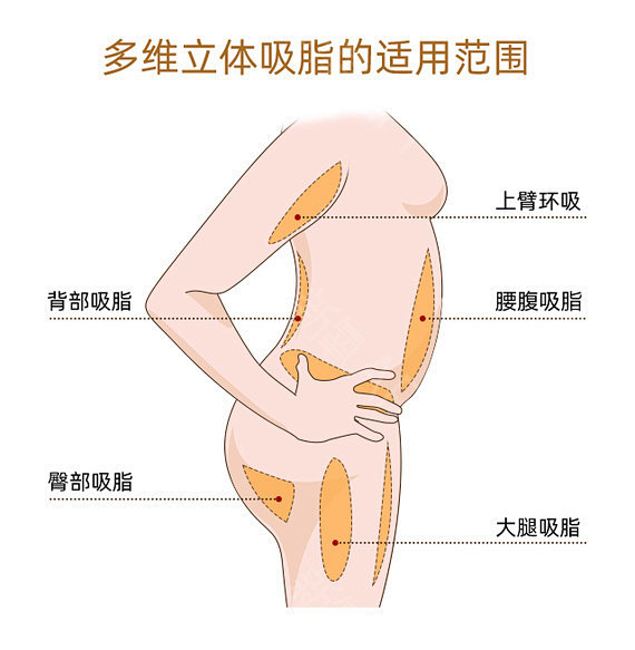 【面部吸脂】（朱金成面吸）单部位①CCT...