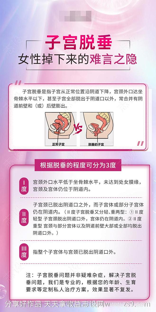 二次元 子宫  脱出 子宫脱垂-源文件-志设网-zs9.com