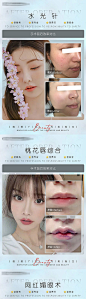 医美案例对比分享 【原图下载】微信小程序搜索@美业小行星
