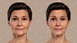 Antiaging beauty treatment