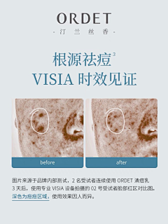 这些年的青春&与爱无关采集到对比