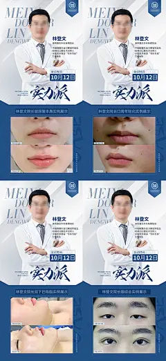 海报 医美 抗衰 玻尿酸 口周年轻化 双下巴 眼综合 双眼皮 案例 对比 医生 人物 
