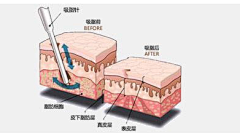 o4OjqZrE采集到医美素材
