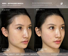 霏girl采集到案例水印