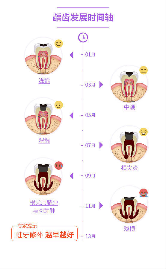 龋齿发展的搜索结果_百度图片搜索
