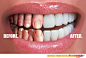八戒分享一则创意牙齿广告《重口味》 - 影视生活创意 穿衣搭配_八戒创意生活网