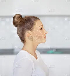 thread lift , nonsurgical procedure,lower facelift