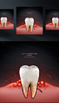 牙齿清洁修护保护牙医院卫生治疗宣传PSD海报模板 Health Dental Care :  