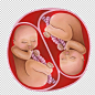 Twins in mother's belly. Digital Body-Art for pregnant image 2