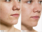 Before/After - SERUM®8