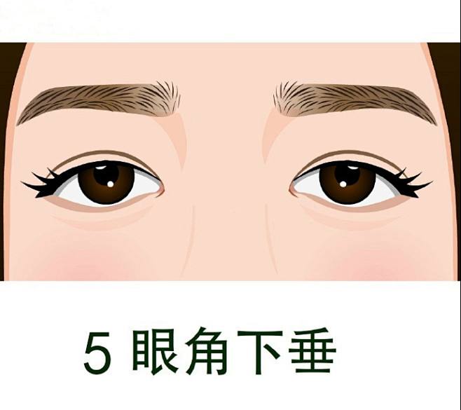 眼部问题  05