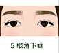 眼部问题  05
