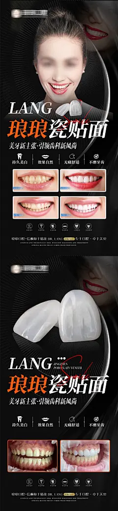 口腔瓷贴面案例海报-志设网-zs9.com