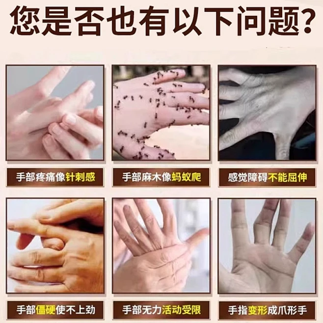 尺神经卡压手指发麻小拇指麻木僵硬手部神经末梢炎受损膏药贴TU-tmall.com天猫-花瓣网