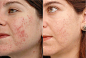 Skin hydration comparison: 1 thousand results found in Yandex Images