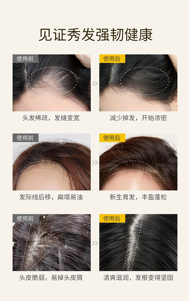 生姜洗发水防脱生发育发液增发密发控油去屑止痒男女正品洗发露膏-tmall.com天猫