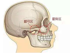 厄洛•斯采集到骨骼