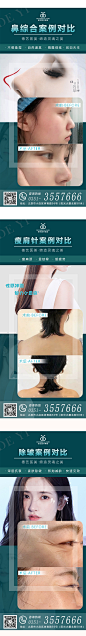 医美案例对比图-素材库-sucai1.cn