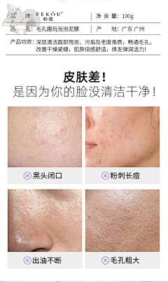 ngclf采集到痛点