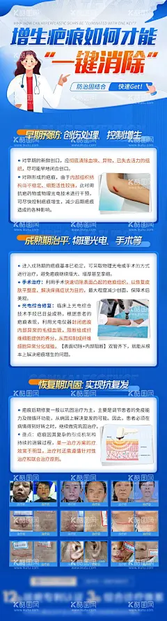 医疗增生疤痕如何才能一键消除科普海报  - 源文件下载【酷图网】专题设计,长图,医疗,疤痕,科普,插画,