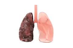 3D渲染的肺部结构插画下载