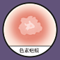 疤痕 疤痕消除 疤痕体质 疤痕增生如何消除 疤痕医院 剖腹产疤痕 痘印痘坑 手术疤痕 增生性疤痕 纹身疤痕 凹陷性疤痕 疤痕疙瘩