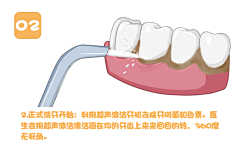 插画小雪采集到医美，口腔，洗牙